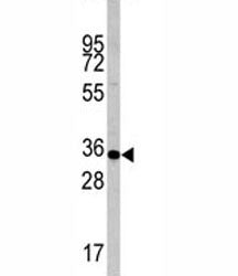 Caspase-6 Antibody, 0.4ml