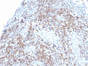 IHC staining of FFPE human tonsil with recombinant ZAP70 antibody. HIER: boil tissue sections in pH 