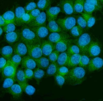 CAMK2A Antibody / CAMK II alpha
