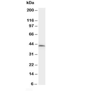 Western blot testing of NPHS2 antibody and rat kidney tissue lysate. Predicted molecular weight ~42k