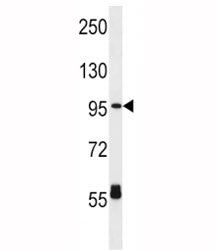 CPT1C Antibody