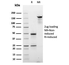 SDS-PAGE analysis of purified, BSA-free Cyclin E1 antibody (clone CCNE1/2587) as confirmation of int
