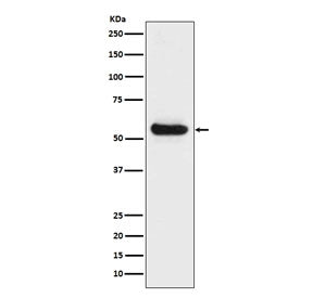 Lipoprotein lipase Antibody / LPL