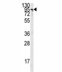Angiotensin-converting enzyme 2 Antibody