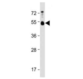 BMP15 Antibody