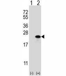 Claudin 1 Antibody