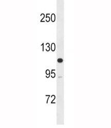 Western blot testing of human SK-BR-3 lysate with MLCK antibody. Predicted molecular weight: isoform
