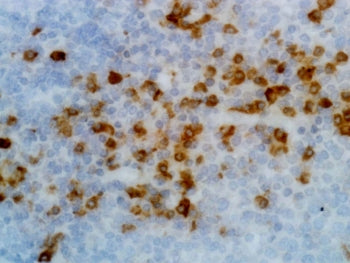 Kappa Light Chain Antibody