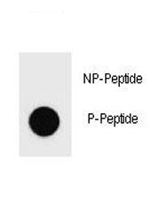Phospho-PARP Antibody (pS177)