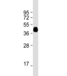 MBP tag Antibody