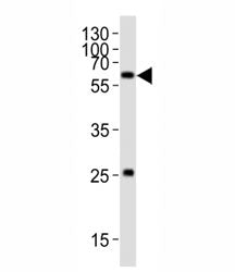 Western blot analysis of lysate from HT-1080 cell line using SMAD1 antibody; Ab was diluted at 1:100
