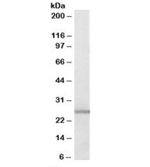 GSTM1 Antibody