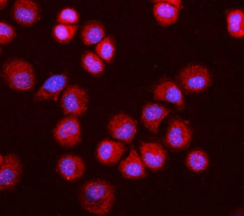 Immunofluorescent staining of FFPE human T-47D cells with O-GlcNAcase antibody (red) and DAPI nuclea