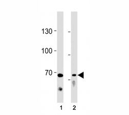 TICAM1 antibody western blot analysis in (1) Ramos cell line and (2) mouse liver tissue lysate. Pred