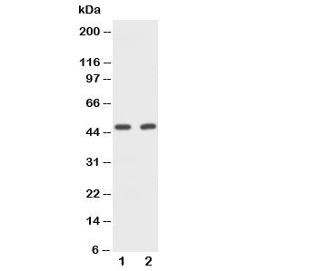 Western blot testing of CD2 antibody and Lane 1: rat spleen; 2: mouse NIH3T3 cell lysate
