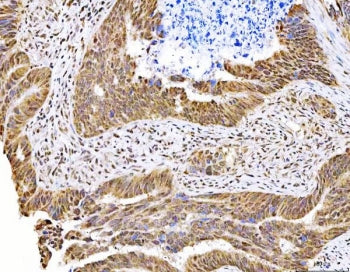 MAGED4 Antibody / Melanoma-associated antigen D4