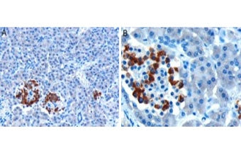 IHC testing of FFPE human pancreas with CCKAR antibody at 10ug/ml. HIER: microwaved with pH6 citrate buffer, HRP-staining.