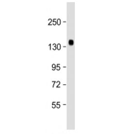 Western blot testing of Klotho antibody at 1:2000 + human kidney lysate. Predicted molecular weight 