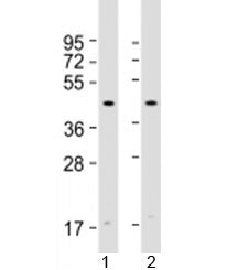Atrogin 1 Antibody / FBXO32
