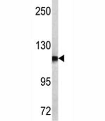 NPEPPS Antibody