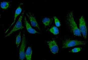 MT-ND5 Antibody / NADH-ubiquinone oxidoreductase chain 5