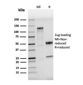 SDS-PAGE analysis of purified, BSA-free TLR4 antibody (clone TLR4/3895R) as confirmation of integrit