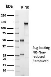 Estrogen Receptor beta 1 Antibody
