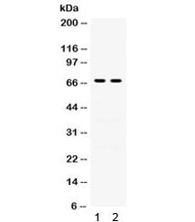 Western blot testing of human 1) A431 and 2) A549 lysate with Involucrin antibody. Predicted molecul