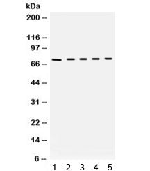Western blot testing of mouse 1) lung, 2) testis, 3) liver, 4) HEPA and 5) NEURO lysate with Bradyki