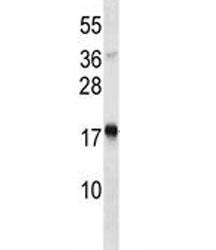 TSLP Antibody