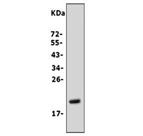 Fibroblast Growth Factor 7 Antibody / FGF7