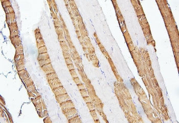 TNNI2 Antibody