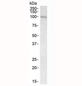 Western blot testing of human bone marrow lysate with VAV3 antibody at 1ug/ml. Predicted molecular w