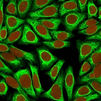 Immunofluorescent staining of human HeLa cells with CK18 antibody (clone KRT18/836, green) and Reddo