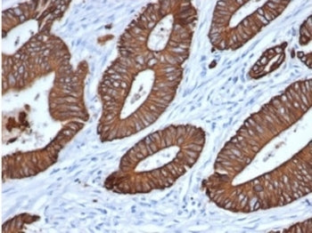 IHC staining of FFPE human colon tissue with Pan Cytokeratin antibody (clone MonoPoly/7249R). HIER: 
