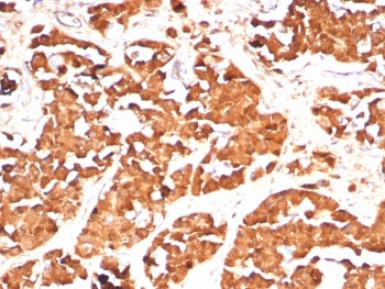 IHC staining of FFPE human pituitary tissue with GH1 antibody (clone GH/8136R). HIER: boil tissue se