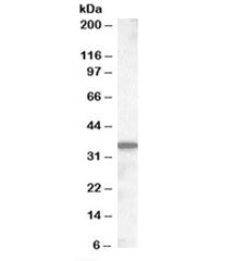 Slc10a2 Antibody