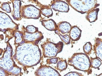 EGF Receptor / EGFR Antibody