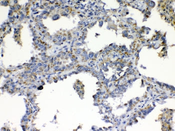 TIMP4 Antibody