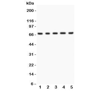 Western blot testing of Menin antibody and Lane 1: human HeLa; 2: (h) 293T; 3: (h) SMMC-7721; 4: mou