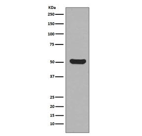 KRT16 Antibody / Cytokeratin 16