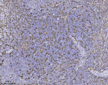 IHC staining of FFPE human tonsil tissue with AIF-1 antibody, HRP-secondary and DAB substrate. HIER: boil tissue sections in pH8 EDTA for 20 min and allow to cool before testing.