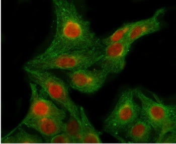 Immunofluorescent staining of FFPE human A549 cells with RPB2 antibody (red) and Beta Tubulin mAb (g