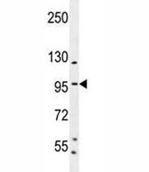 Specificity Protein 1 Antibody (SP1)