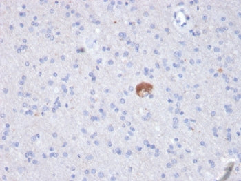 Amyloid beta Antibody / APP