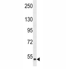 ZAK Antibody (MLKLAK)