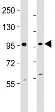 Western blot testing of EZH2 antibody at 1:2000 dilution. Lane 1: mouse F9 lysate; 2: human K562 lys