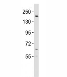 Western blot testing of KDM6B antibody at 1:2000 dilution + mouse lung lysate; Predicted molecular w