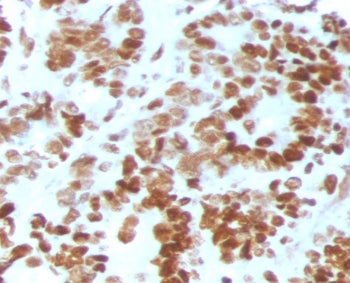 MSH6 Antibody