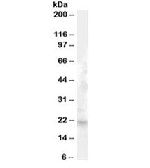 Western blot testing of human liver lysate with FGF21 antibody at 1ug/ml. Predicted molecular weight